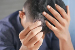 Why Hair Falls Out: This Is What The Experts Say