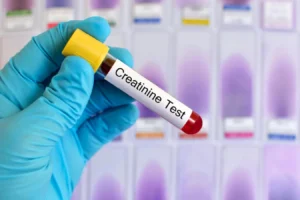 What Is Creatinine: What Are The Normal Values ​​And What happens If It Is High Or Low