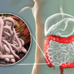 Parasites: What They Are, Symptoms, Causes, Risks, Complications And Prevention