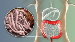 Parasites: What They Are, Symptoms, Causes, Risks, Complications And Prevention