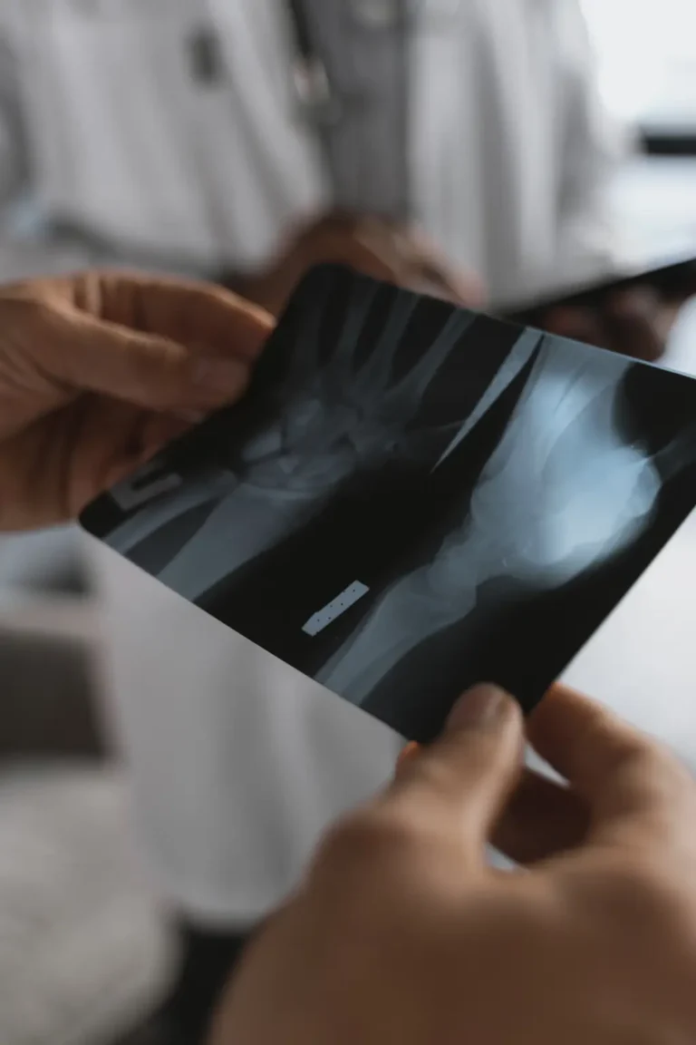 Fractures, Broken Bones, Fissures – Do You Know All The Care You Need?