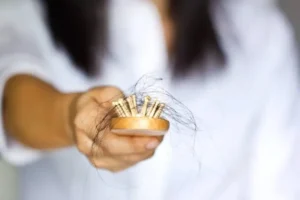 Women Also Suffer From Alopecia: These Are The Best Treatments