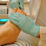 How To Treat Toenail Fungus?