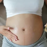 How To Prevent Stretch Marks During Pregnancy