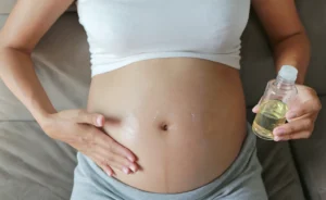 How To Prevent Stretch Marks During Pregnancy