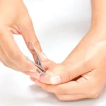 How To Treat An Ingrown Toenail And How To Prevent This Condition