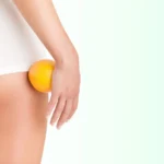 Thinking About Your Summer Body? 10 Myths About Cellulite